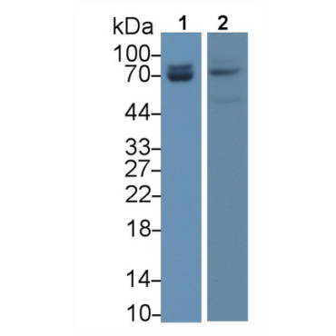 Lamin A/C (LMNA) Human Monoclonal Antibody