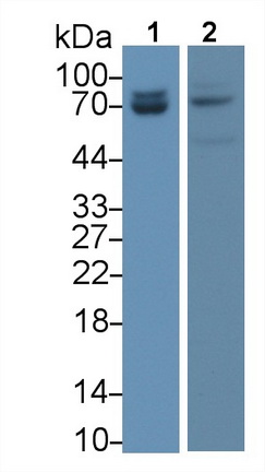 Lamin A/C (LMNA) Human Monoclonal Antibody