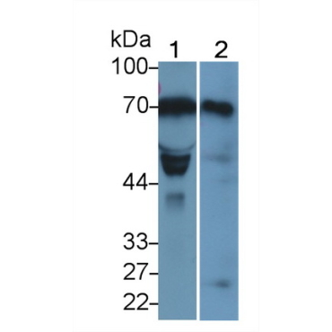 Lysyl Oxidase Like Protein 1 (LOXL1) Human Monoclonal Antibody
