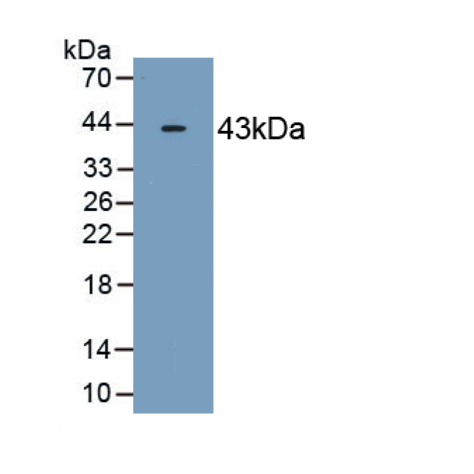 2',5'-Oligoadenylate Synthetase 2 (OAS2) Human Monoclonal Antibody