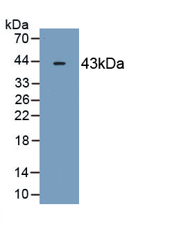 2',5'-Oligoadenylate Synthetase 2 (OAS2) Human Monoclonal Antibody