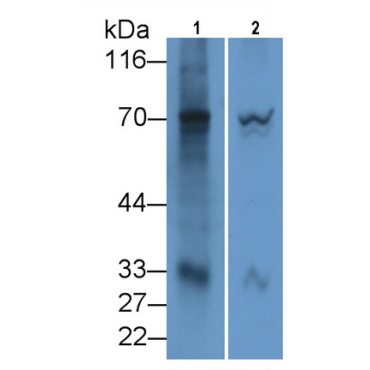 2',5'-Oligoadenylate Synthetase 2 (OAS2) Human Monoclonal Antibody