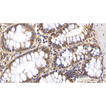 2',5'-Oligoadenylate Synthetase 2 (OAS2) Human Monoclonal Antibody