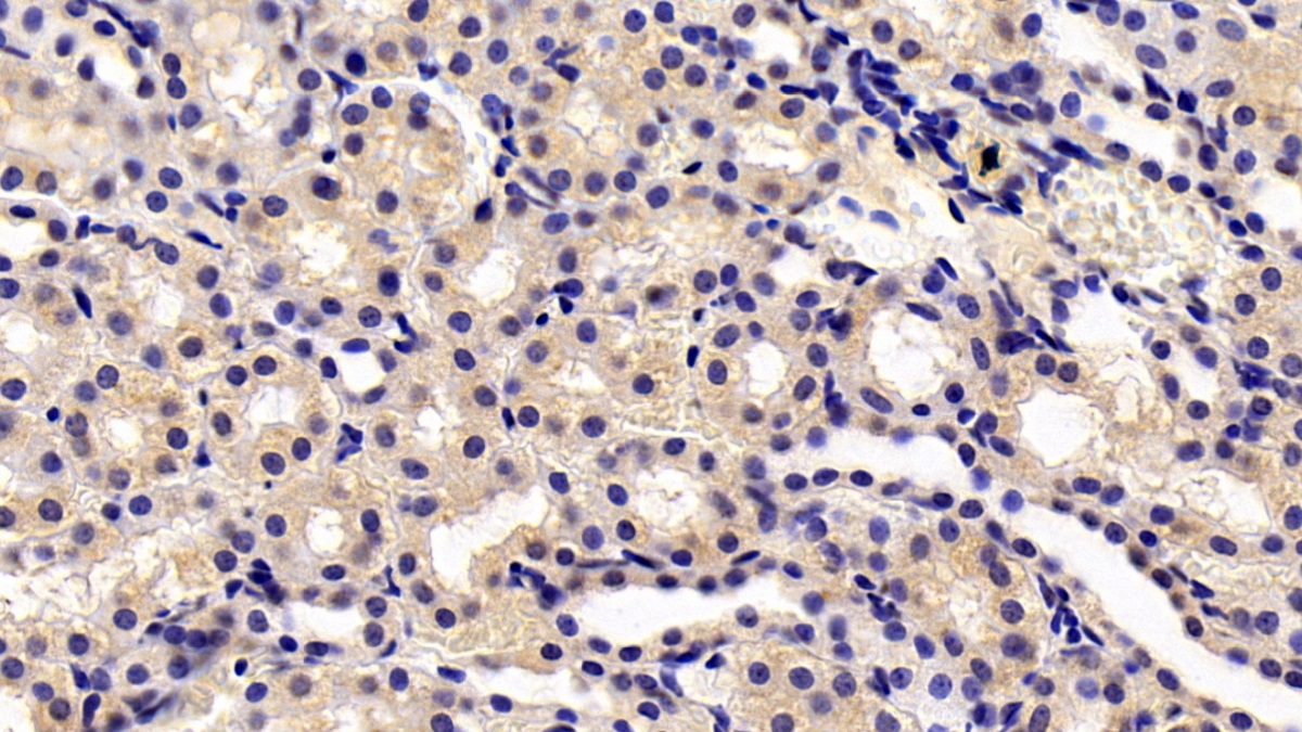 Transient Receptor Potential Cation Channel Subfamily M, Member 4 (TRPM4) Rat Monoclonal Antibody