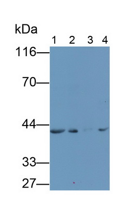 Secreted Frizzled Related Protein 4 (SFRP4) Human Monoclonal Antibody