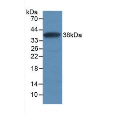 Secreted Frizzled Related Protein 1 (SFRP1) Human Monoclonal Antibody