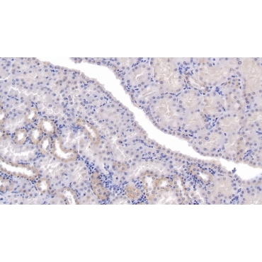 Secreted Frizzled Related Protein 1 (SFRP1) Human Monoclonal Antibody