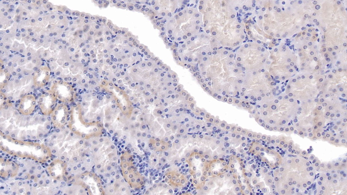 Secreted Frizzled Related Protein 1 (SFRP1) Human Monoclonal Antibody