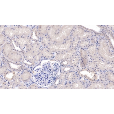 Secreted Frizzled Related Protein 1 (SFRP1) Human Monoclonal Antibody