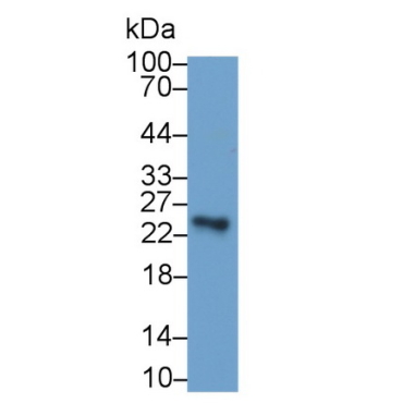 Sclerostin Domain Containing Protein 1 (SOSTDC1) Human Monoclonal Antibody