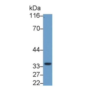 Stanniocalcin 2 (STC2) Human Monoclonal Antibody