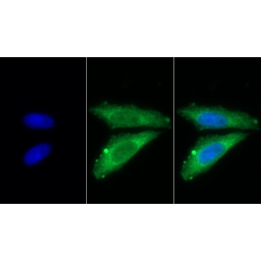 Stanniocalcin 2 (STC2) Human Monoclonal Antibody