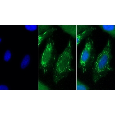 Stanniocalcin 2 (STC2) Human Monoclonal Antibody