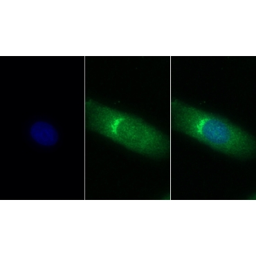 Stanniocalcin 2 (STC2) Human Monoclonal Antibody