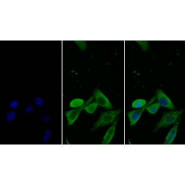 Stanniocalcin 2 (STC2) Human Monoclonal Antibody