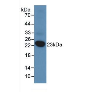 Dual Specificity Phosphatase 3 (DUSP3) Human Monoclonal Antibody