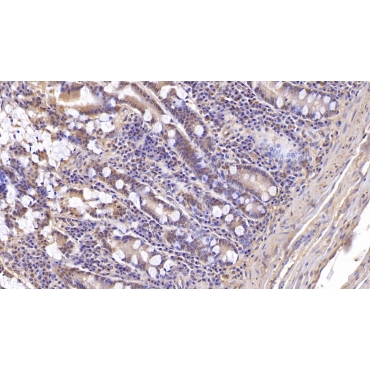Aspartate Beta Hydroxylase (ASPH) Human Monoclonal Antibody