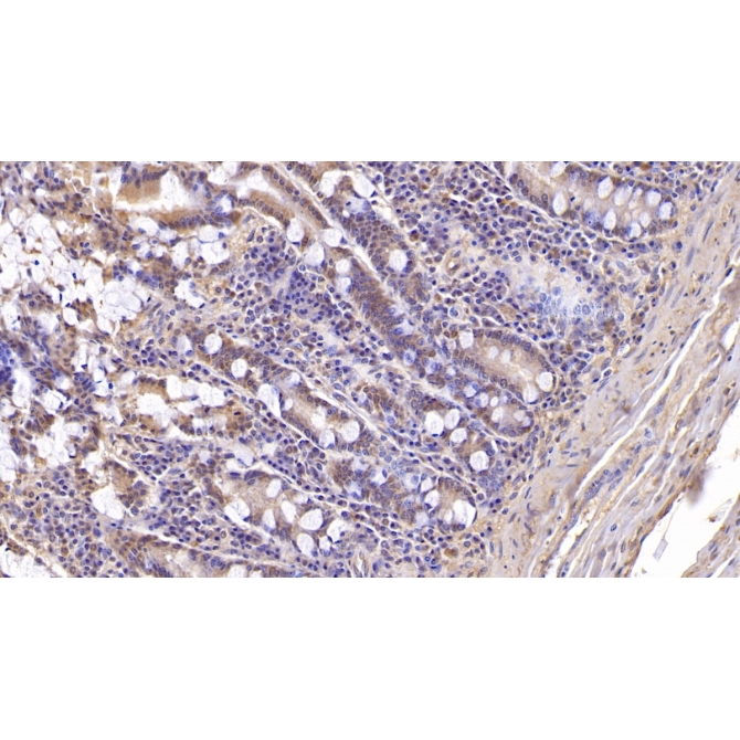 Aspartate Beta Hydroxylase (ASPH) Human Monoclonal Antibody
