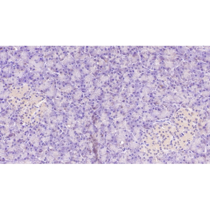 Aspartate Beta Hydroxylase (ASPH) Human Monoclonal Antibody