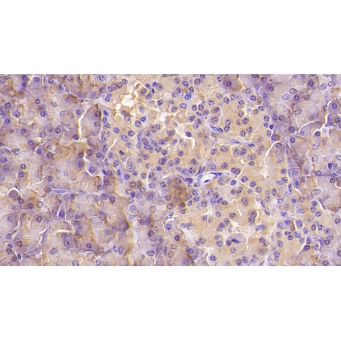 Aspartate Beta Hydroxylase (ASPH) Human Monoclonal Antibody