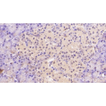 Aspartate Beta Hydroxylase (ASPH) Human Monoclonal Antibody