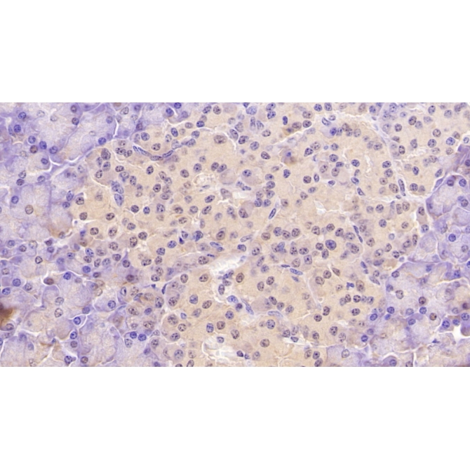 Aspartate Beta Hydroxylase (ASPH) Human Monoclonal Antibody