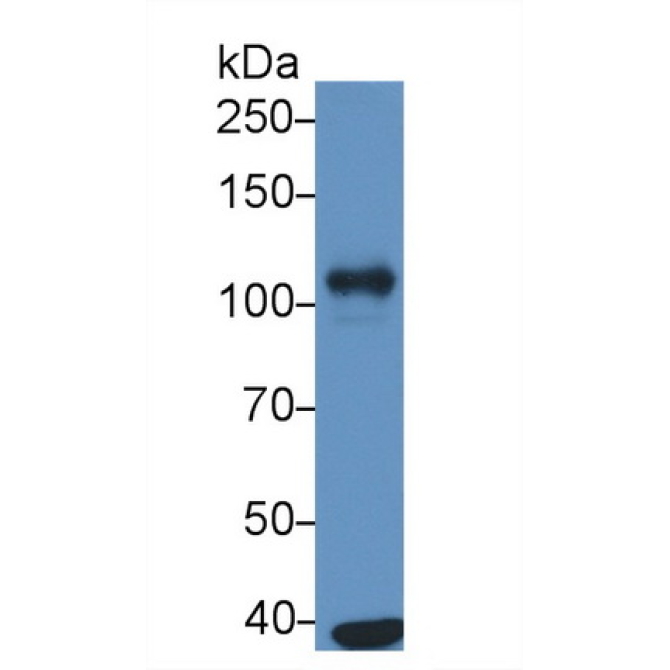 ATPase, Na+/K+ Transporting Alpha 1 Polypeptide (ATP1a1) Human Monoclonal Antibody