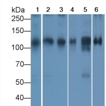 ATPase, Na+/K+ Transporting Alpha 1 Polypeptide (ATP1a1) Human Monoclonal Antibody
