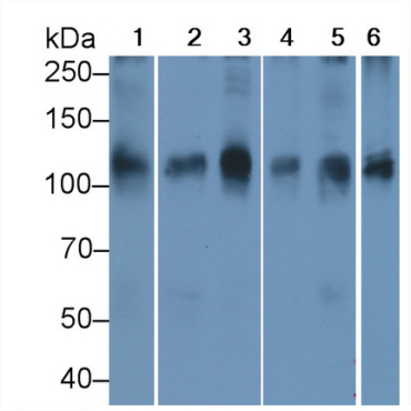 ATPase, Na+/K+ Transporting Alpha 1 Polypeptide (ATP1a1) Human Monoclonal Antibody