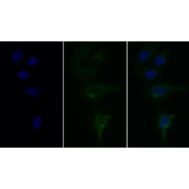 Statherin (STATH) Human Monoclonal Antibody
