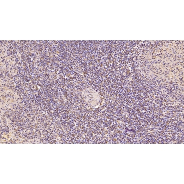 Cerebral Dopamine Neurotrophic Factor (CDNF) Human Monoclonal Antibody