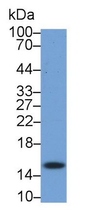 Ring Box Protein 1 (RBX1) Human Monoclonal Antibody