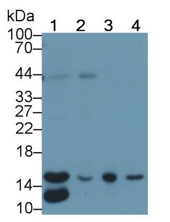 Ring Box Protein 1 (RBX1) Human Monoclonal Antibody