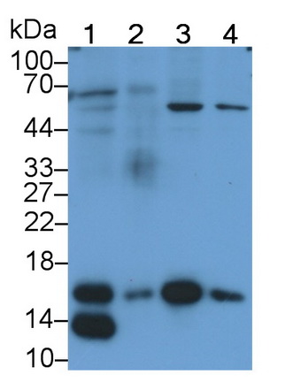 Ring Box Protein 1 (RBX1) Human Monoclonal Antibody