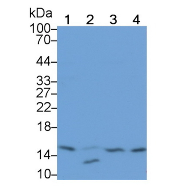 Ring Box Protein 1 (RBX1) Human Monoclonal Antibody