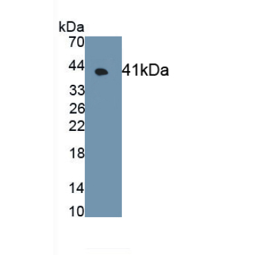 G Protein Coupled Receptor 35 (GPR35) Human Monoclonal Antibody