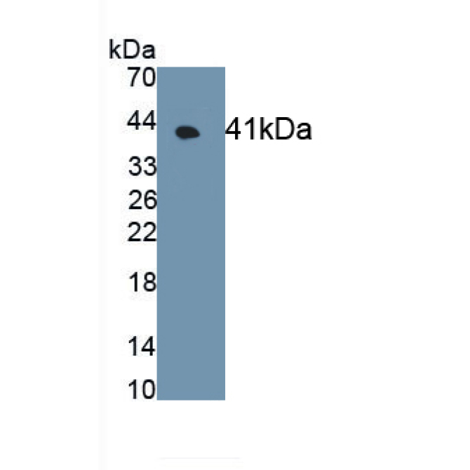 G Protein Coupled Receptor 35 (GPR35) Human Monoclonal Antibody