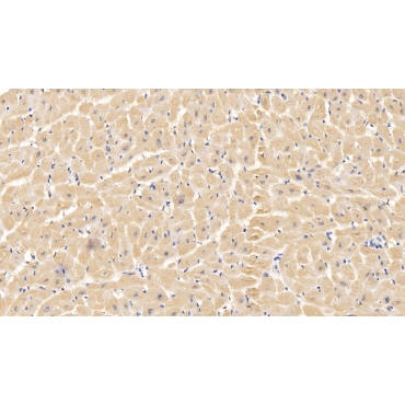 Voltage Dependent Anion Channel Protein 1 (VDAC1) Human Monoclonal Antibody