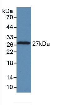 Tumor Protein, Translationally Controlled 1 (TPT1) Human Monoclonal Antibody