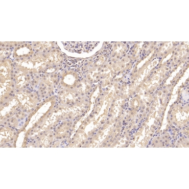 Interferon Alpha 21 (IFNa21) Human Monoclonal Antibody