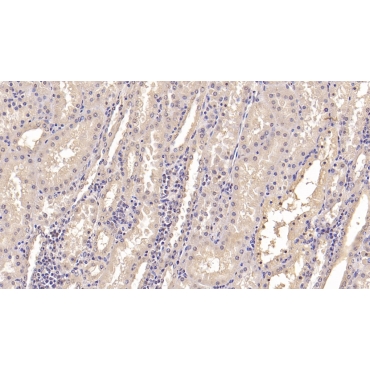 Interferon Alpha 21 (IFNa21) Human Monoclonal Antibody