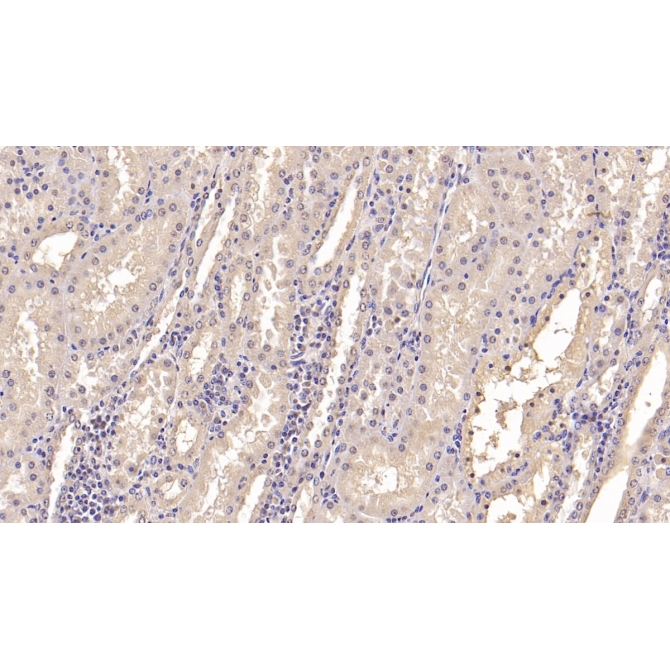 Interferon Alpha 21 (IFNa21) Human Monoclonal Antibody