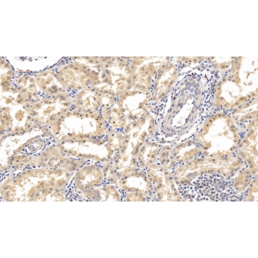 Interferon Alpha 21 (IFNa21) Human Monoclonal Antibody