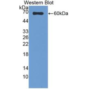 Sulfite Oxidase (SUOX) Human Monoclonal Antibody