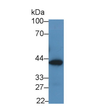 Glutaminyl Peptide Cyclotransferase (QPCT) Human Monoclonal Antibody