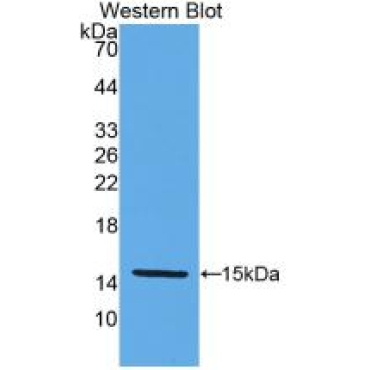 Klotho Beta (KLb) Human Monoclonal Antibody