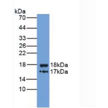 Inter Alpha-Globulin Inhibitor H4 (ITIH4) Human Monoclonal Antibody
