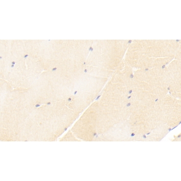 Immunoglobulin Superfamily Containing Leucine Rich Repeat Protein (ISLR) Human Monoclonal Antibody