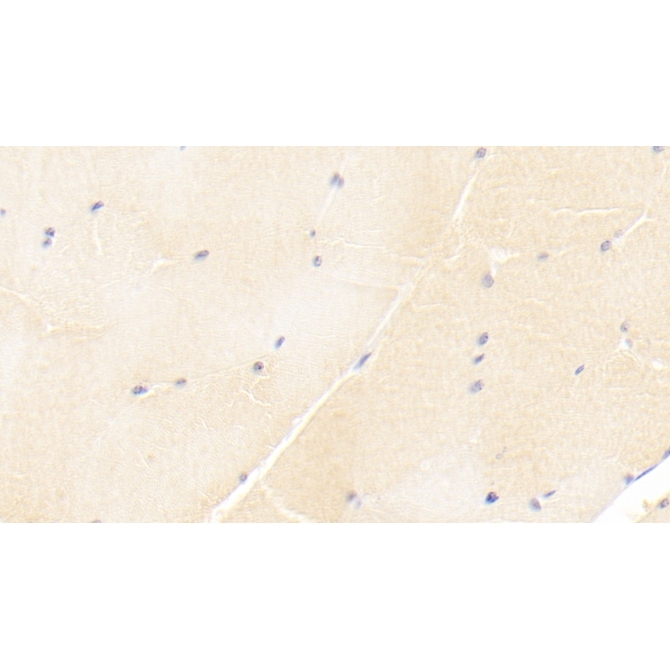 Immunoglobulin Superfamily Containing Leucine Rich Repeat Protein (ISLR) Human Monoclonal Antibody