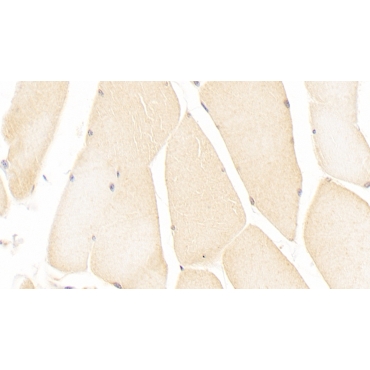 Immunoglobulin Superfamily Containing Leucine Rich Repeat Protein (ISLR) Human Monoclonal Antibody